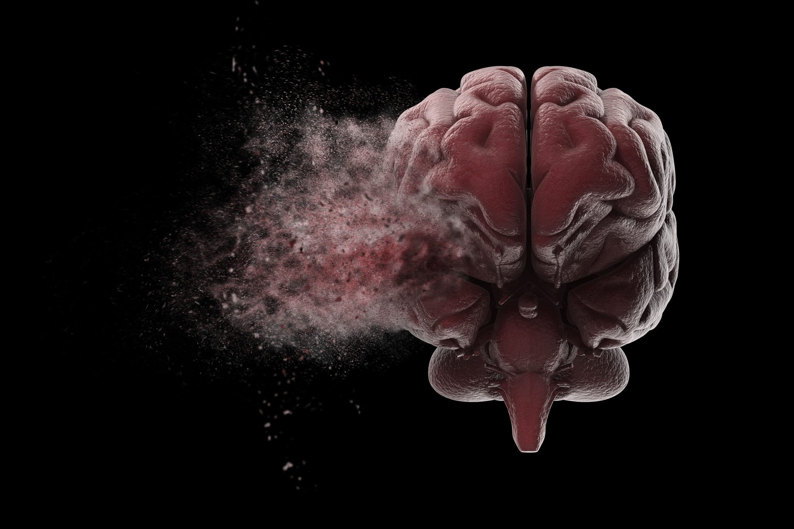 alcohol-related brain damage