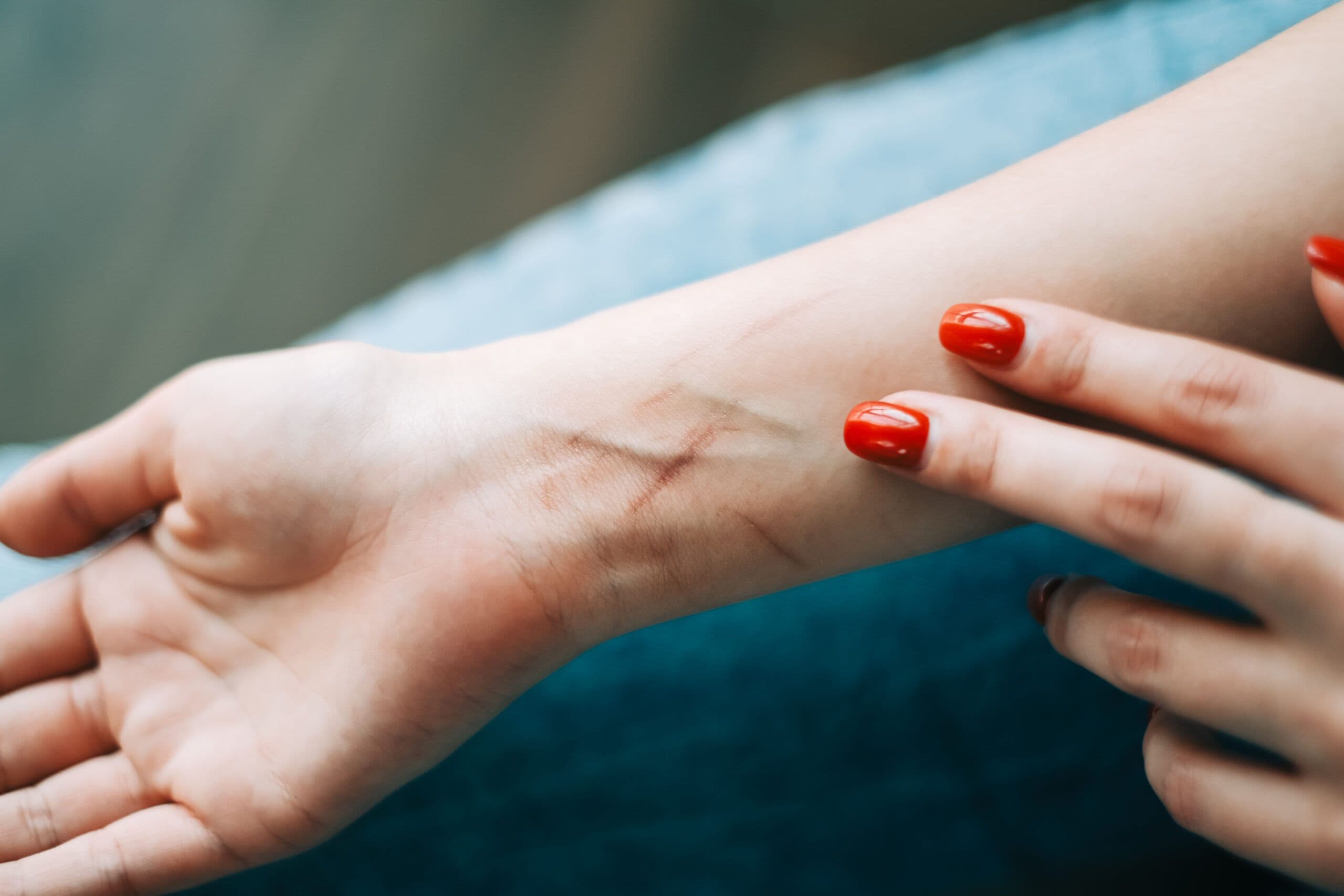 Self-Harm Awareness Month